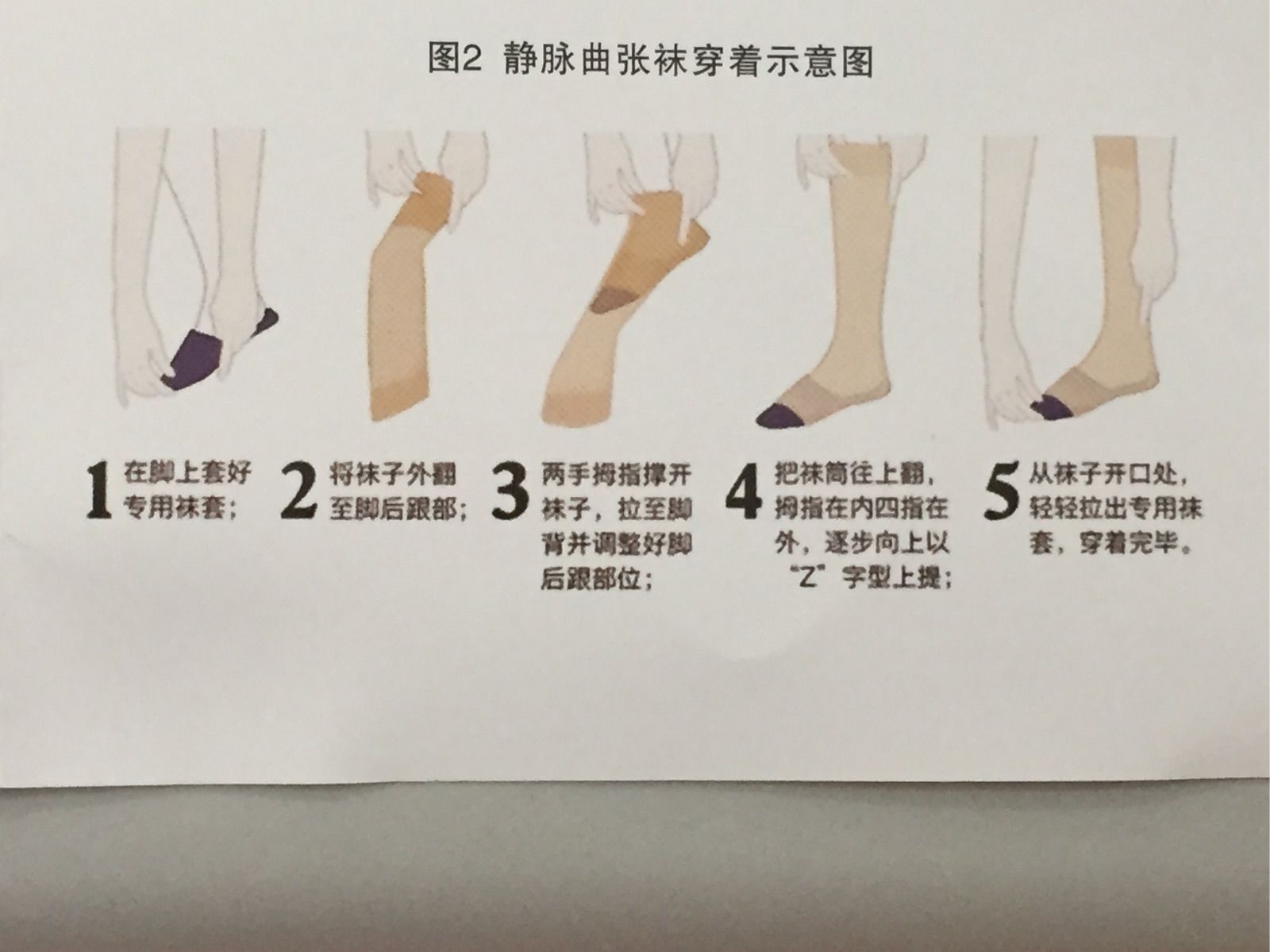 靜脈平可以治精索曲張_穿彈力襪能治好靜脈曲張嗎_雙側靜脈精索曲張圖片