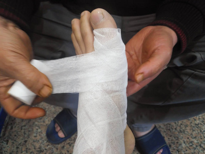 如何綁腳踝繃帶_綁腳踝的繃帶_彈力繃帶腳踝纏法