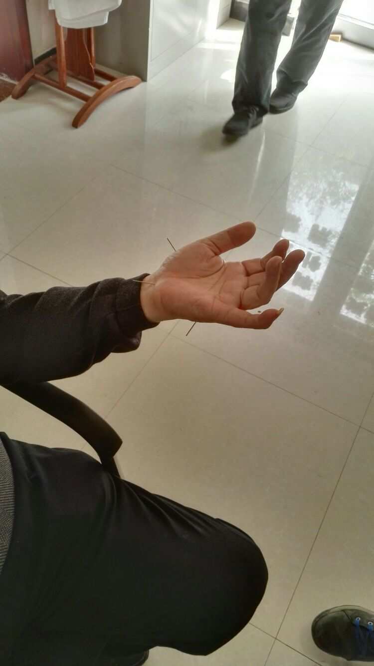 小孩發(fā)燒怎么退燒最快物理降溫_酒精物理降溫退燒的正確方法是什么_什么是物理降溫退燒