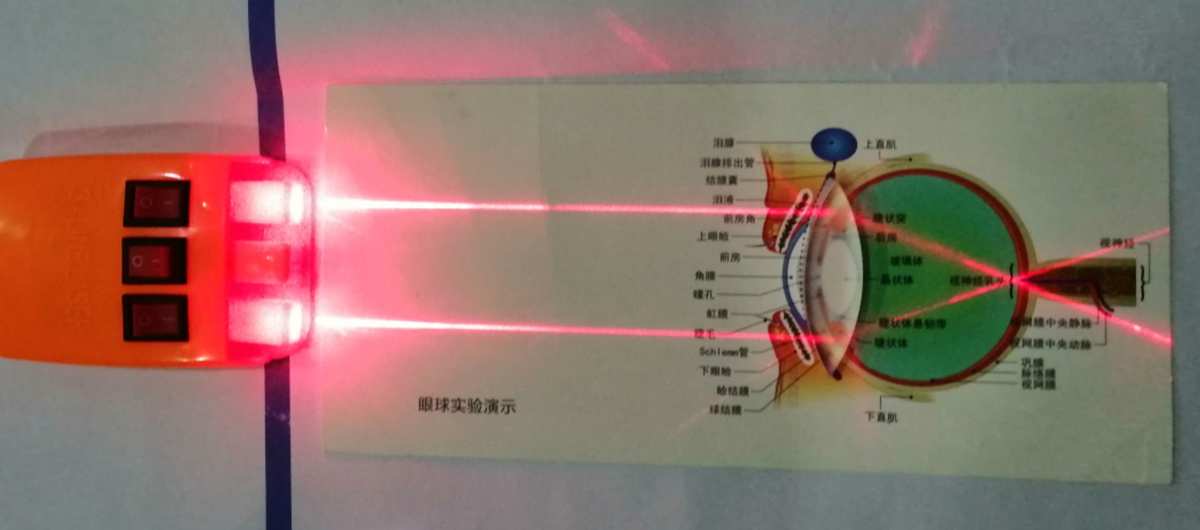 眼球凸透鏡成像原理_凸透鏡模擬眼球成像原理_眼睛凸透鏡成像原理