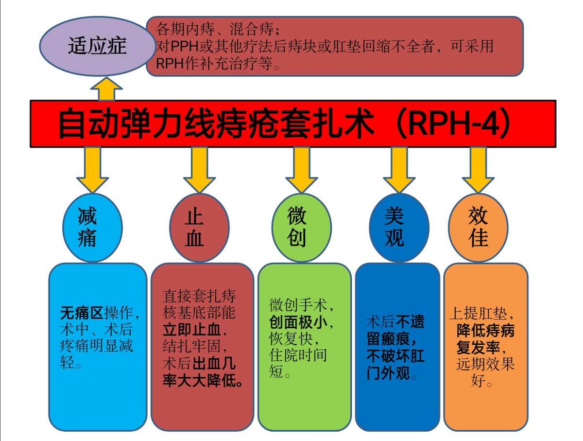 自動彈力線套扎器_自動彈力線套扎器_自動彈力線套扎器