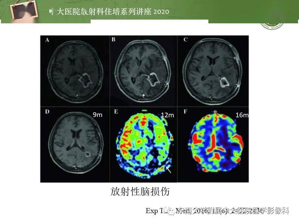 細(xì)胞膜受損的癥狀_細(xì)胞膜受損會(huì)怎么樣_細(xì)胞膜損傷