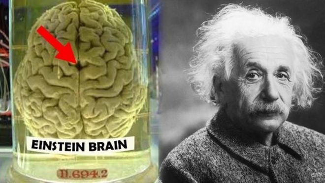 愛因斯坦大腦的區別_愛因斯坦的大腦_愛因斯坦說大腦