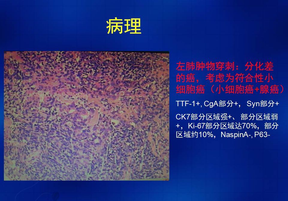 細(xì)胞膜抗原功能_細(xì)胞膜抗原_膜抗原是什么